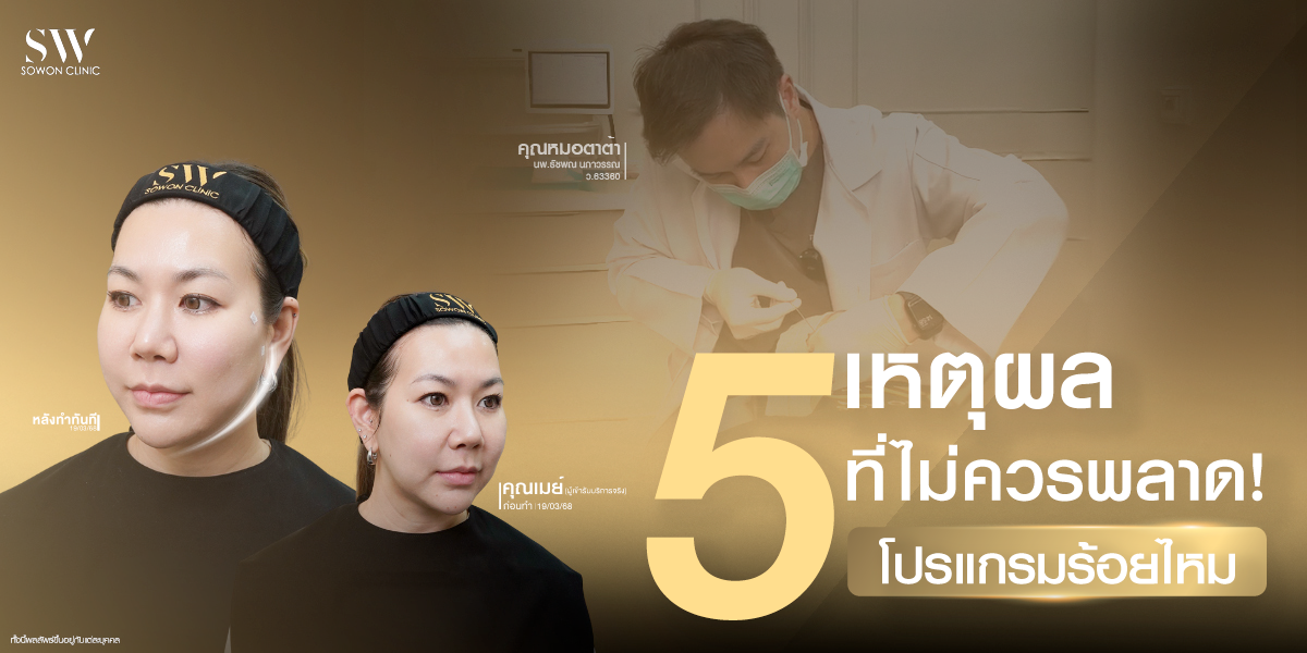 5-facts-about-threads_skin-thread_knowledge 5-facts-about-threads_skin-thread_knowledge