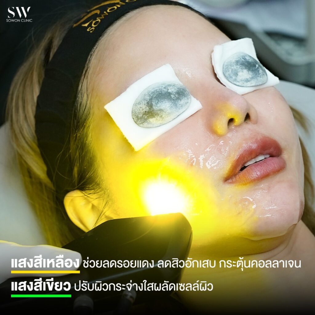 หน้าใส แสงสีเหลือง เขียว