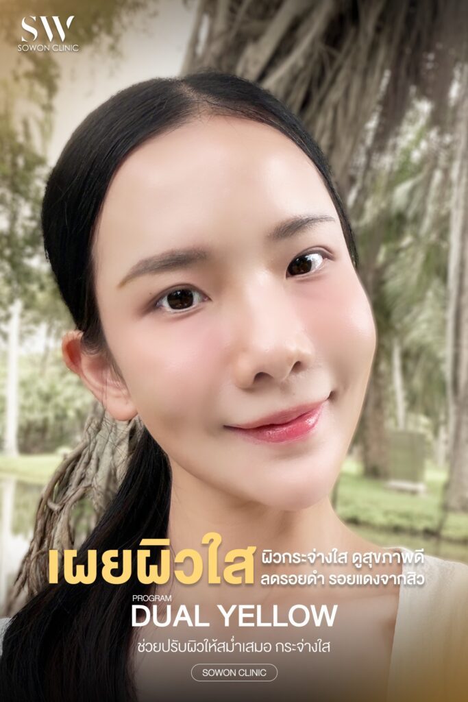 หน้าใส ข้อดี