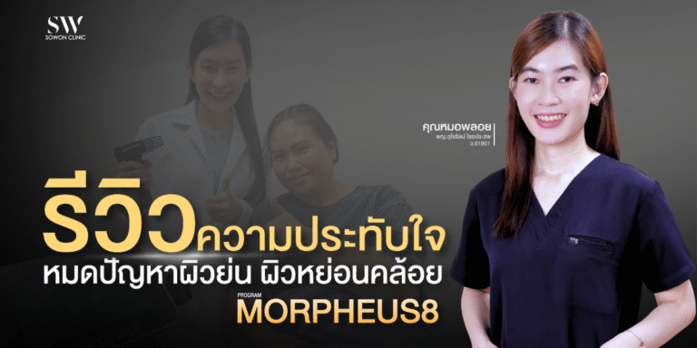 no-more-sagging-and-wrinkles-skin-morpheus8-review
