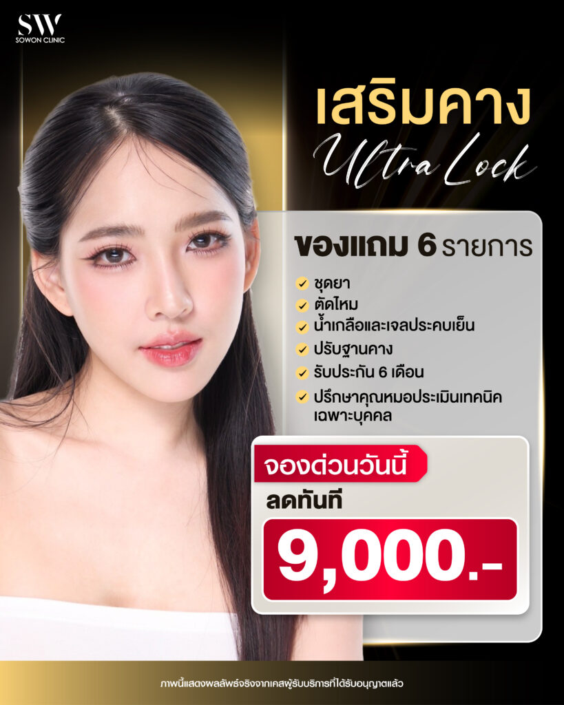 โปรโมชั่นเสริมคาง ของแถม