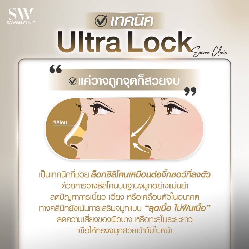 รีวิวเสริมจมูก UTL