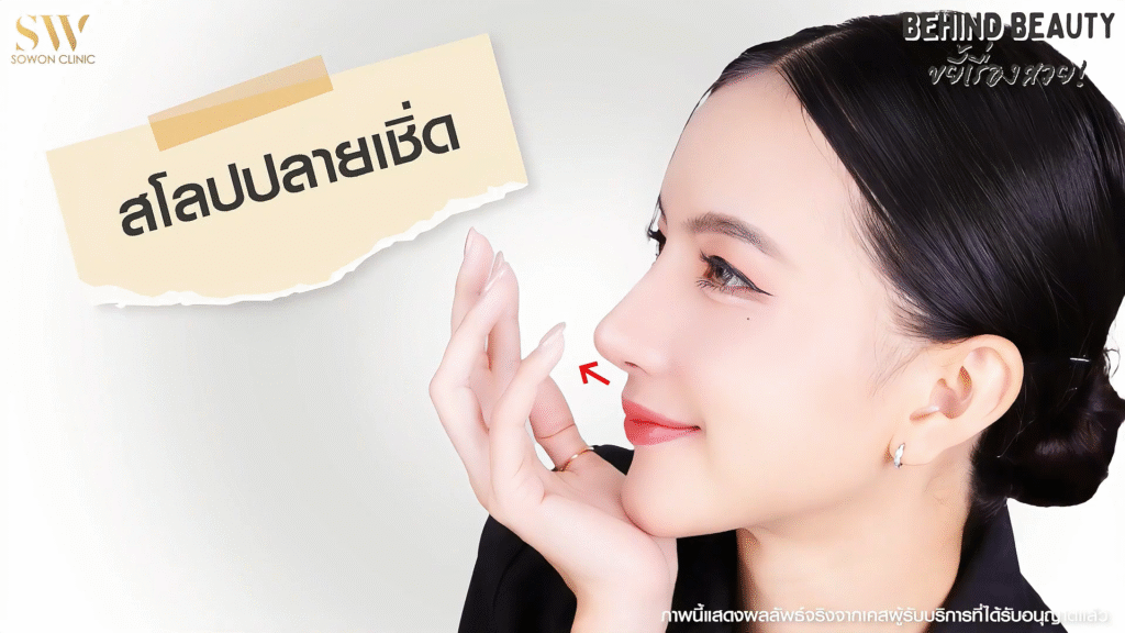 รีวิวเสริมจมูก ทรงจมูกสโลปปลายเชิด