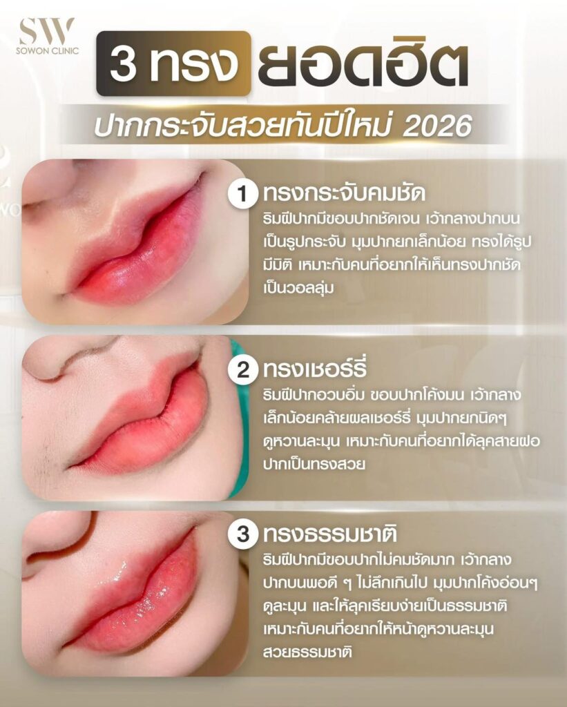 ปากกระจับ 1