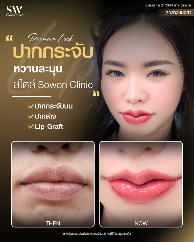 ปากกระจับ 2