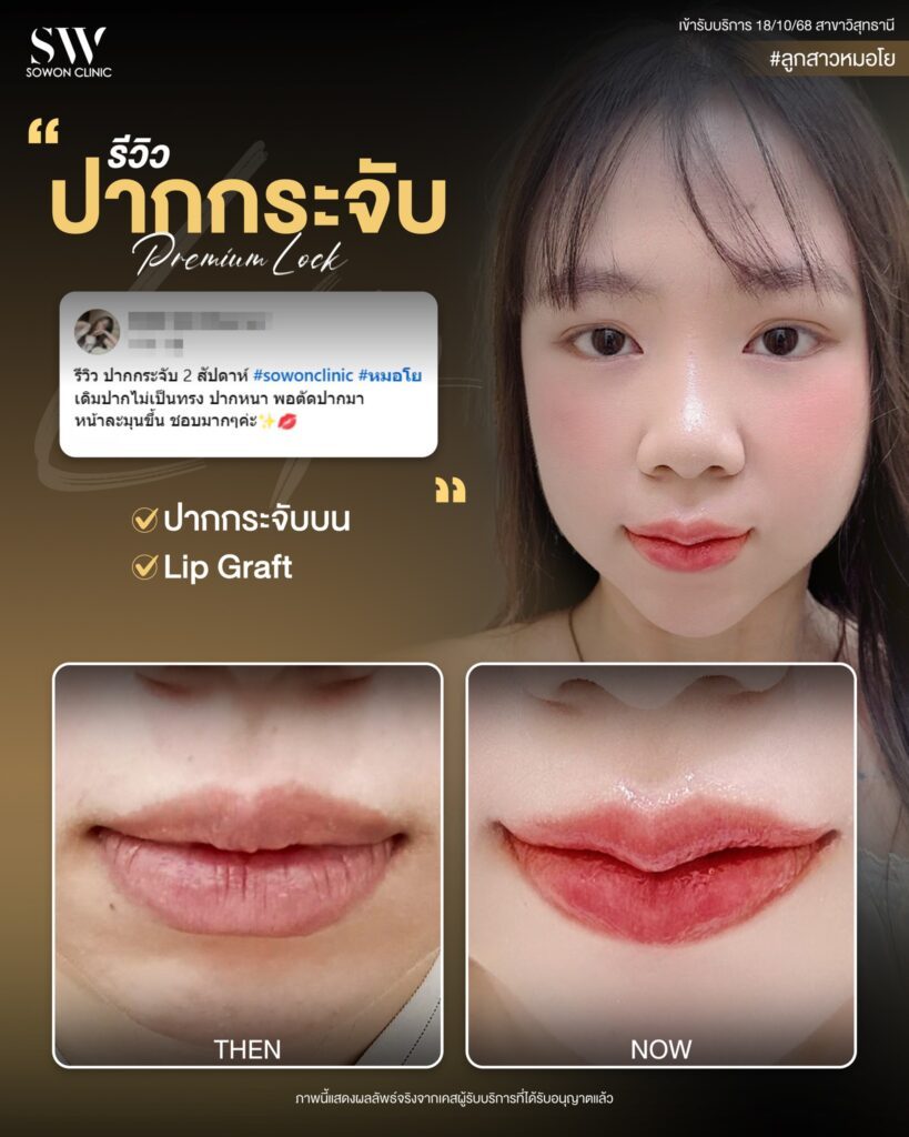 ปากกระจับ 