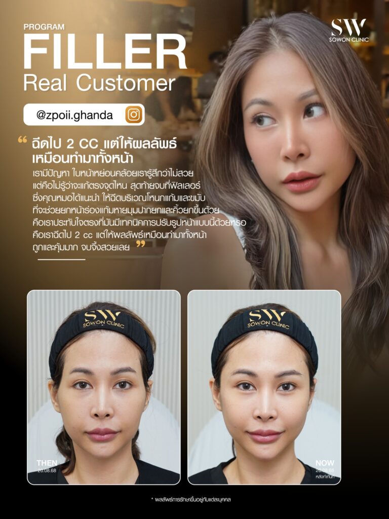 ฟิลเลอร 008