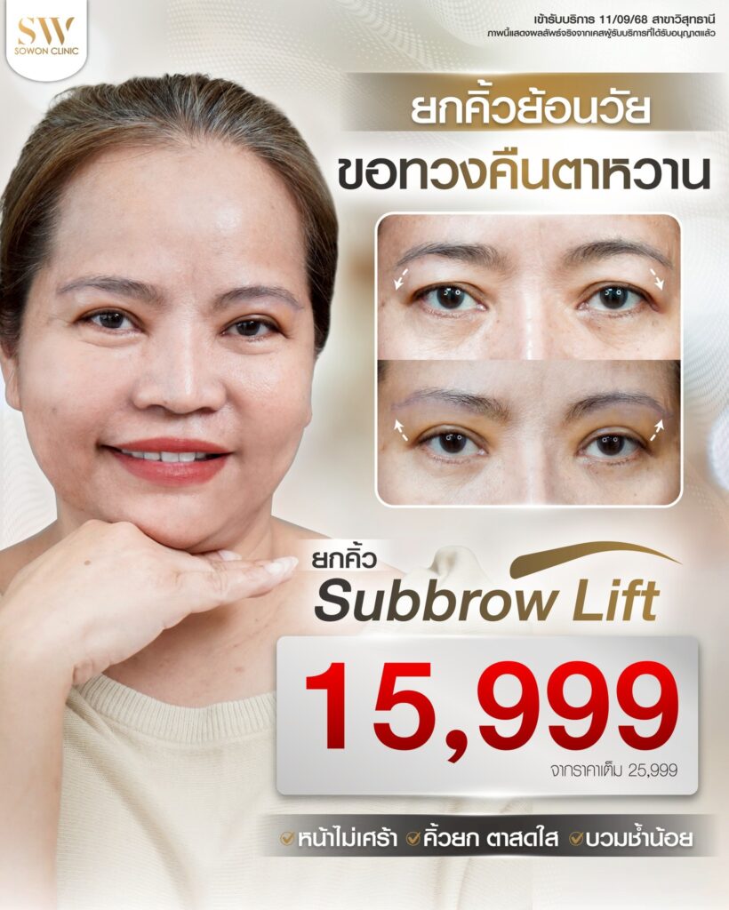 ยกคิ้ว 01