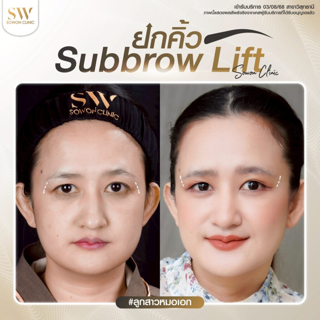 ยกคิ้ว 02