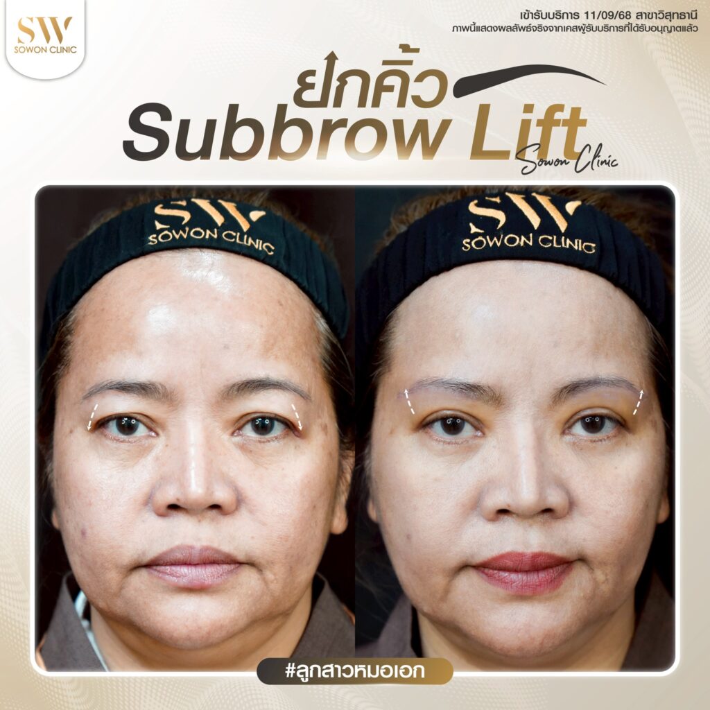 ยกคิ้ว 03