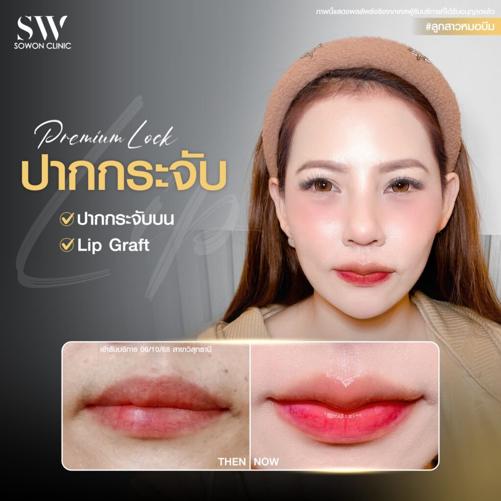 ปากกระจับ