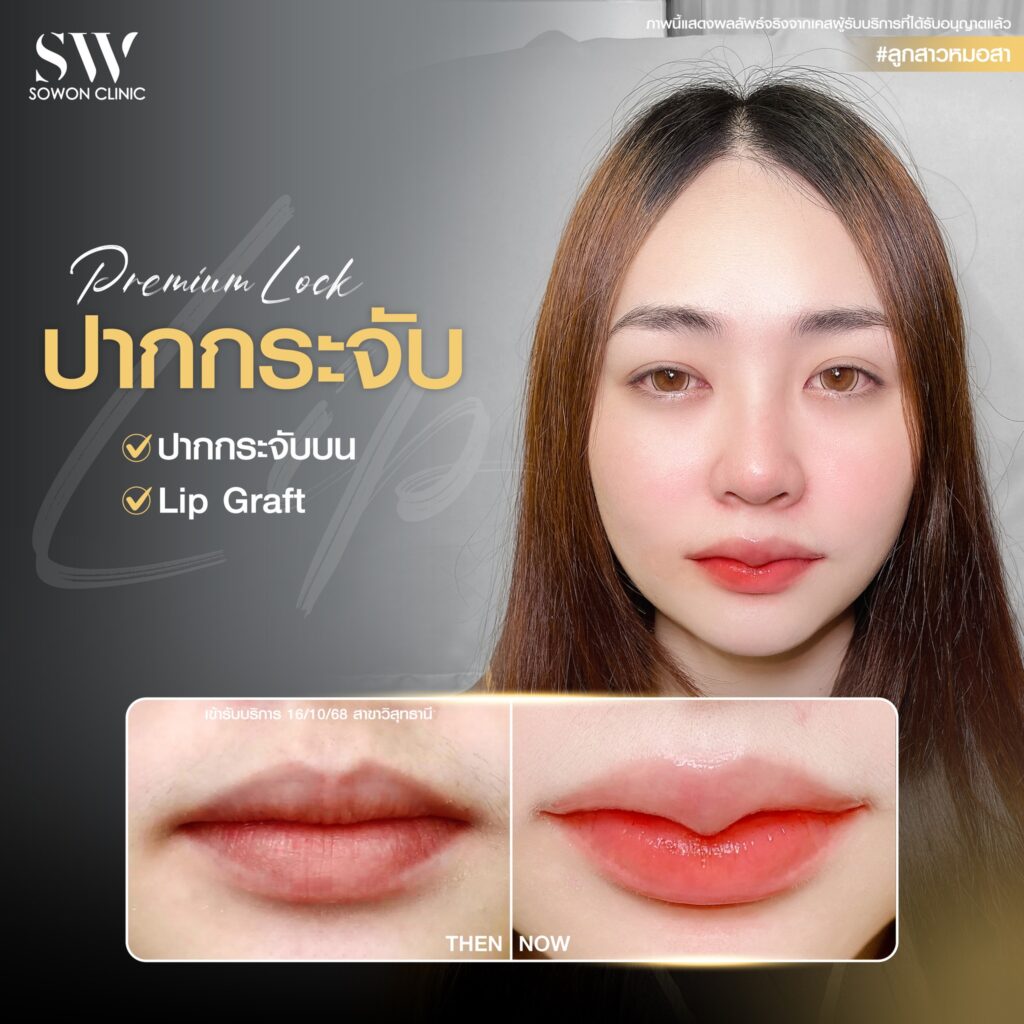 ปากกระจับ