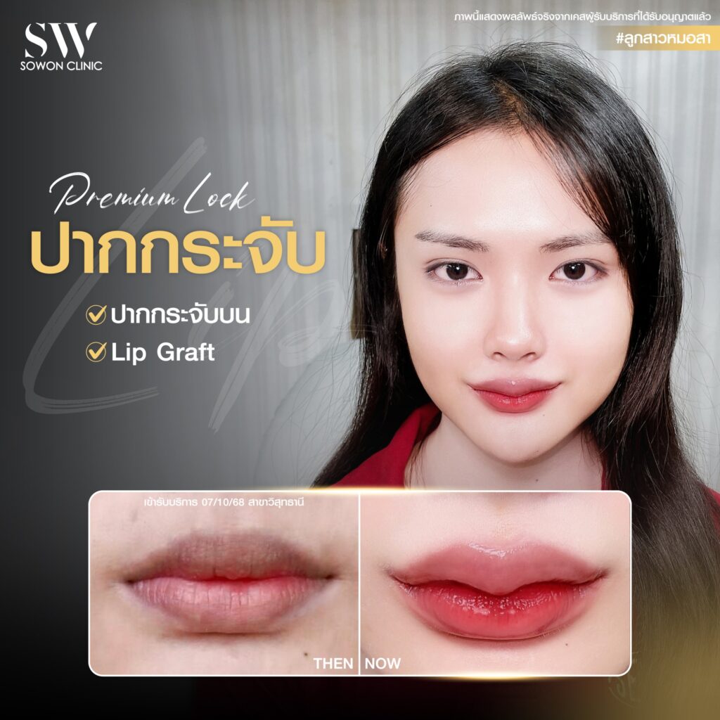 ปากกระจับ