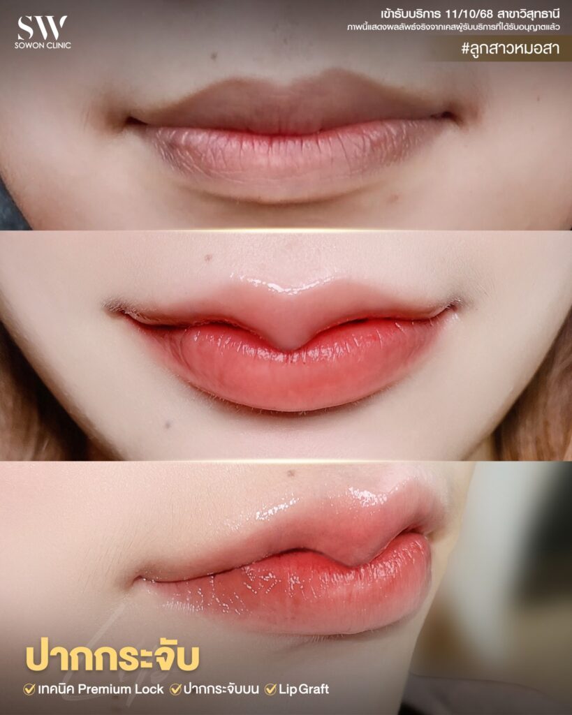 รีวิวปากกระจับ 4