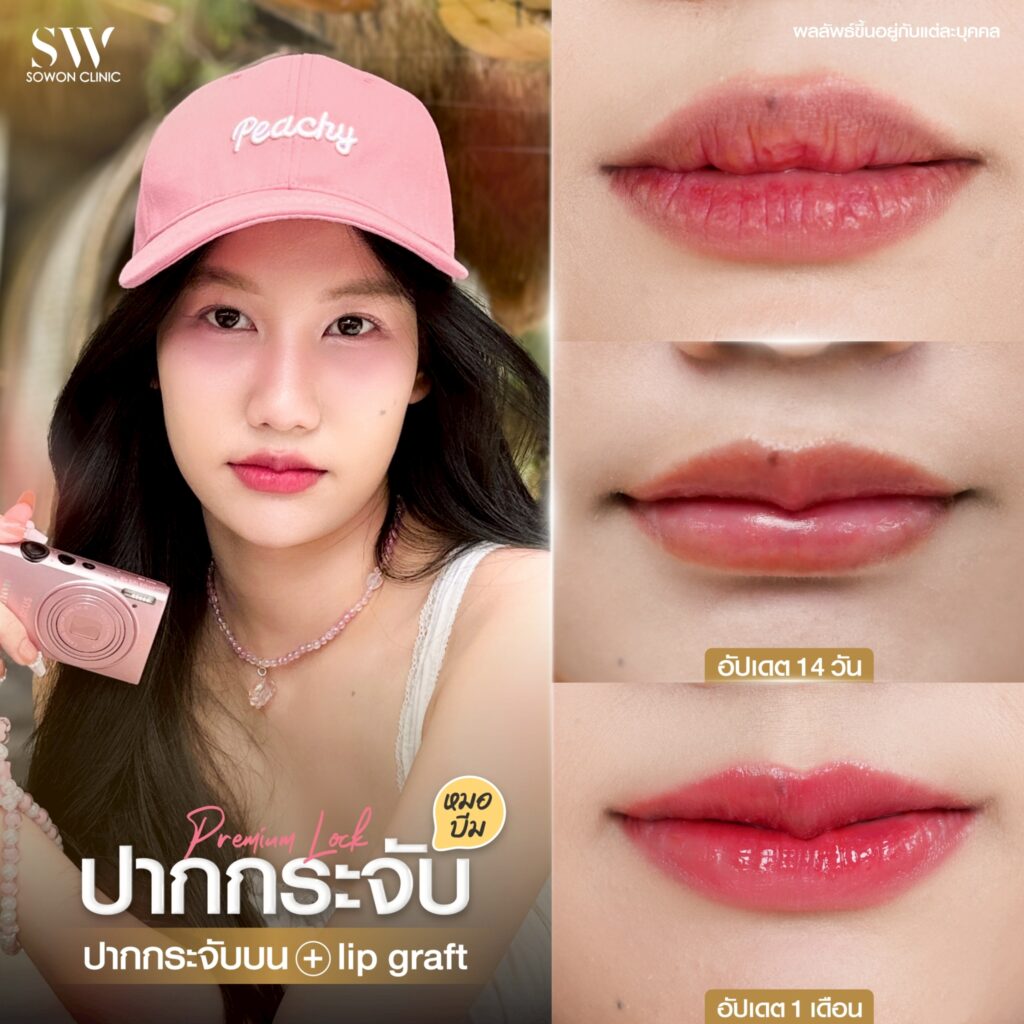 รีวิวปากกระจับ 5