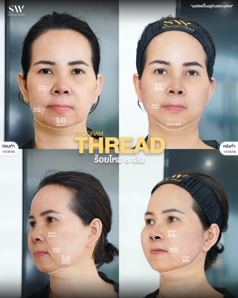 อายุเยอะ ร้อยไหม 02