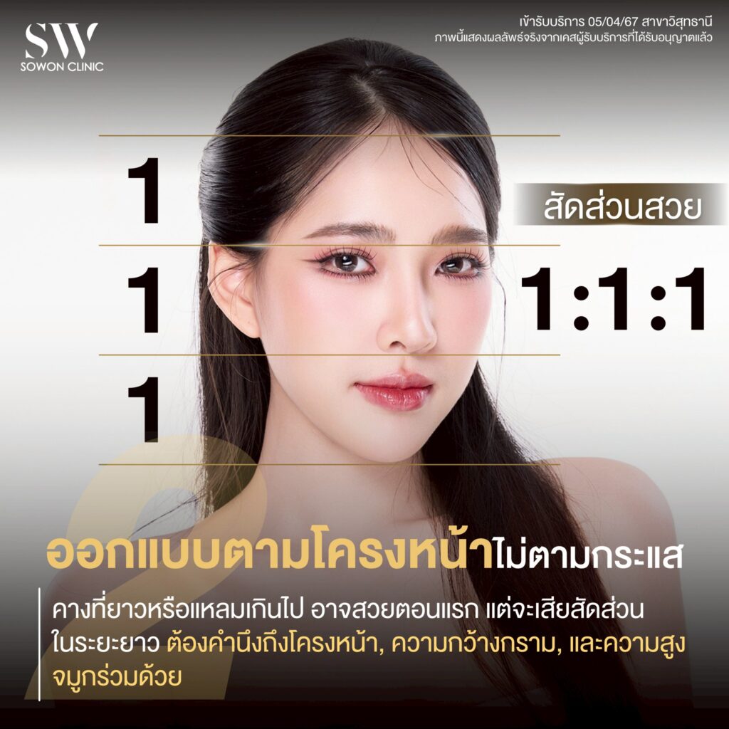 เสริมคาง 004