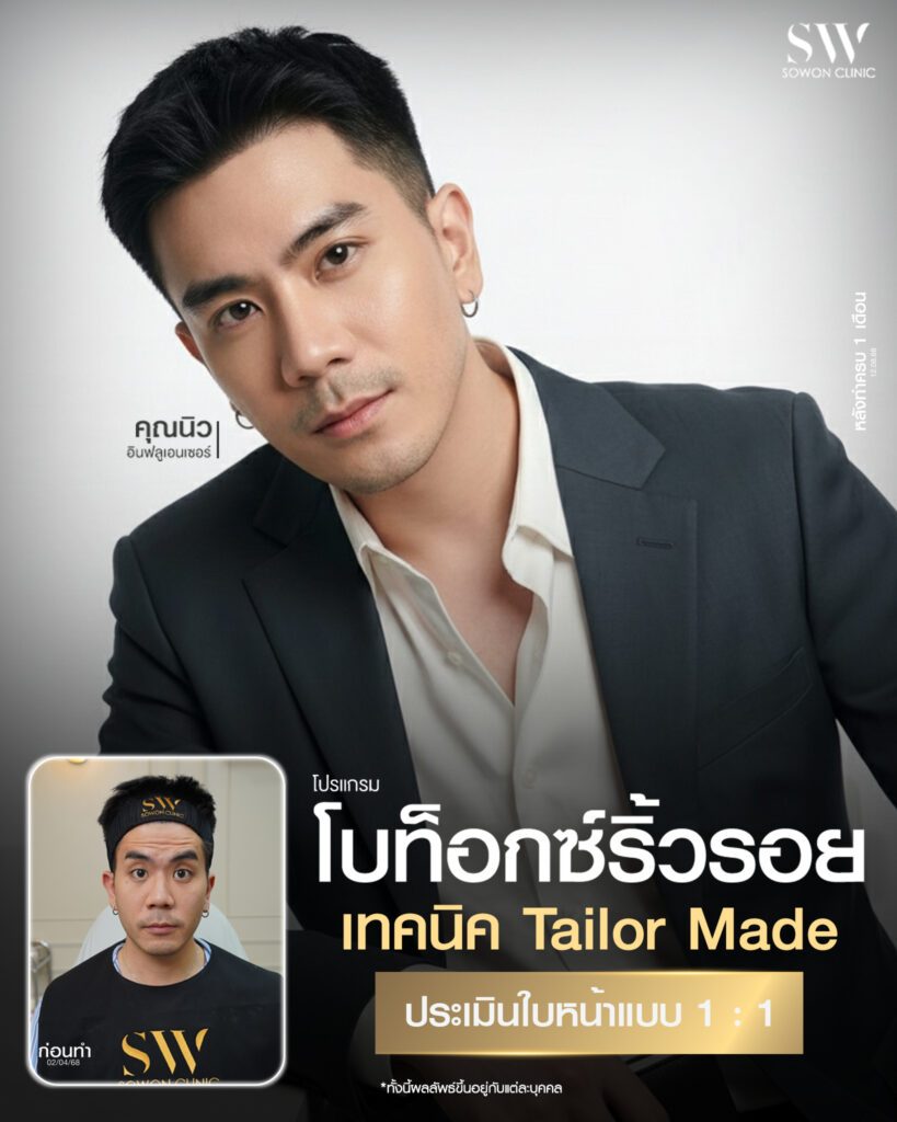 ริ้วรอย รีวิว01