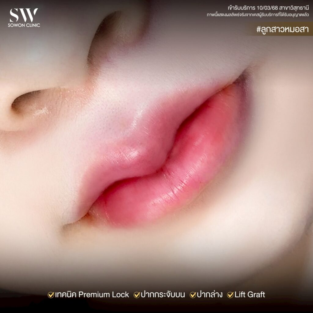 ปากกระจับ_ทรงปาก05