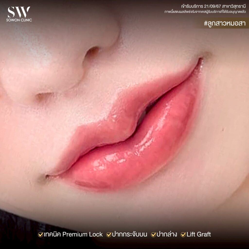 ปากกระจับ_ทรงปาก06