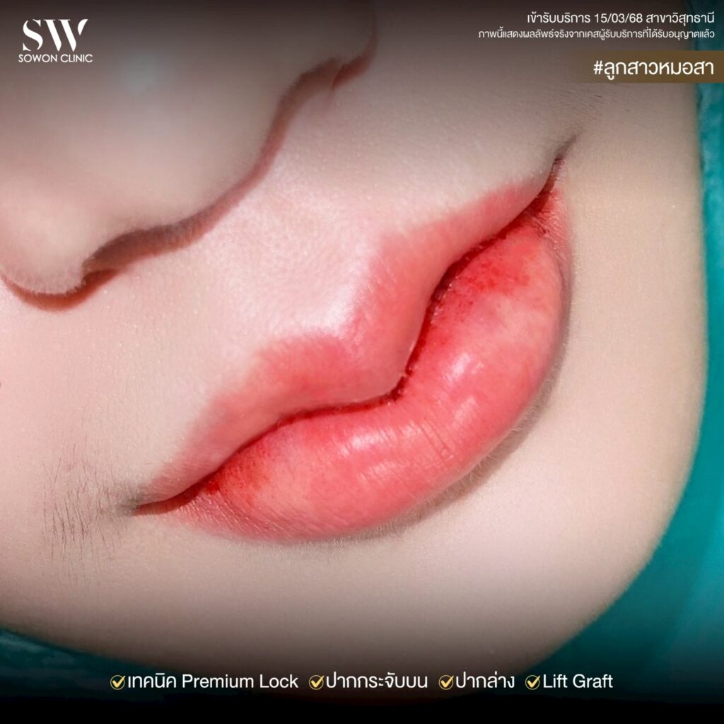 ปากกระจับ_ทรงปาก09