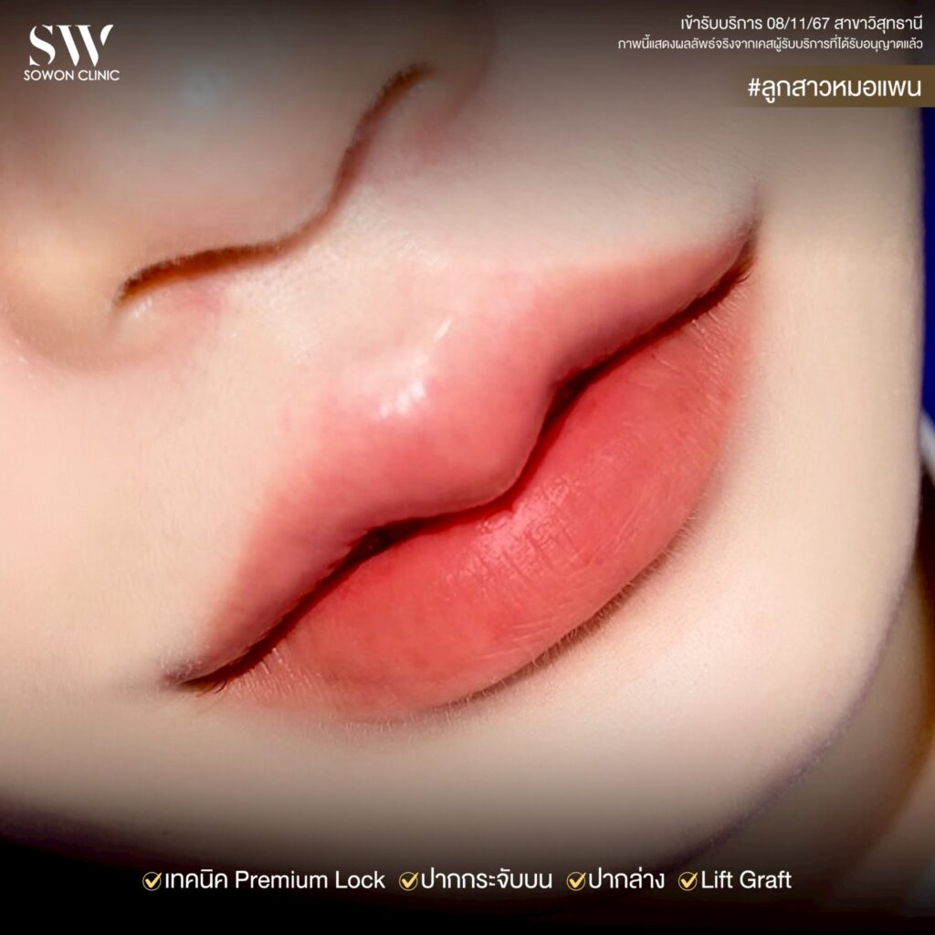 ปากกระจับ_ทรงปาก01