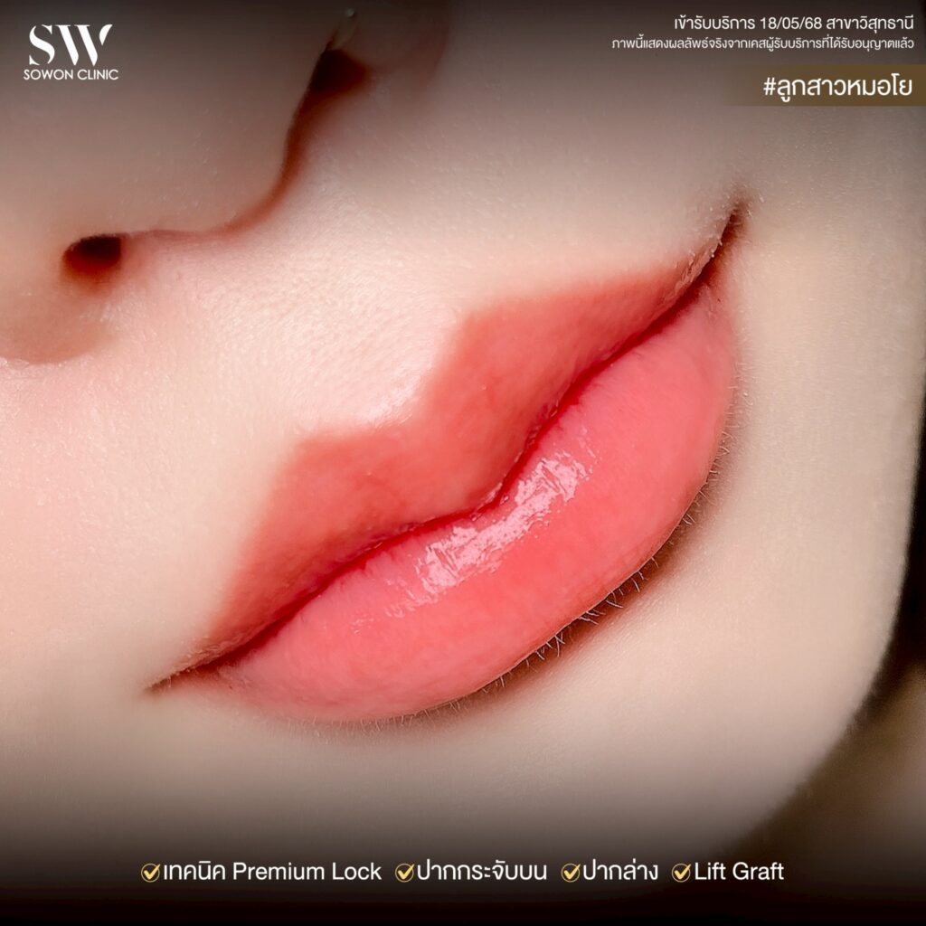 ปากกระจับ_ทรงปาก03