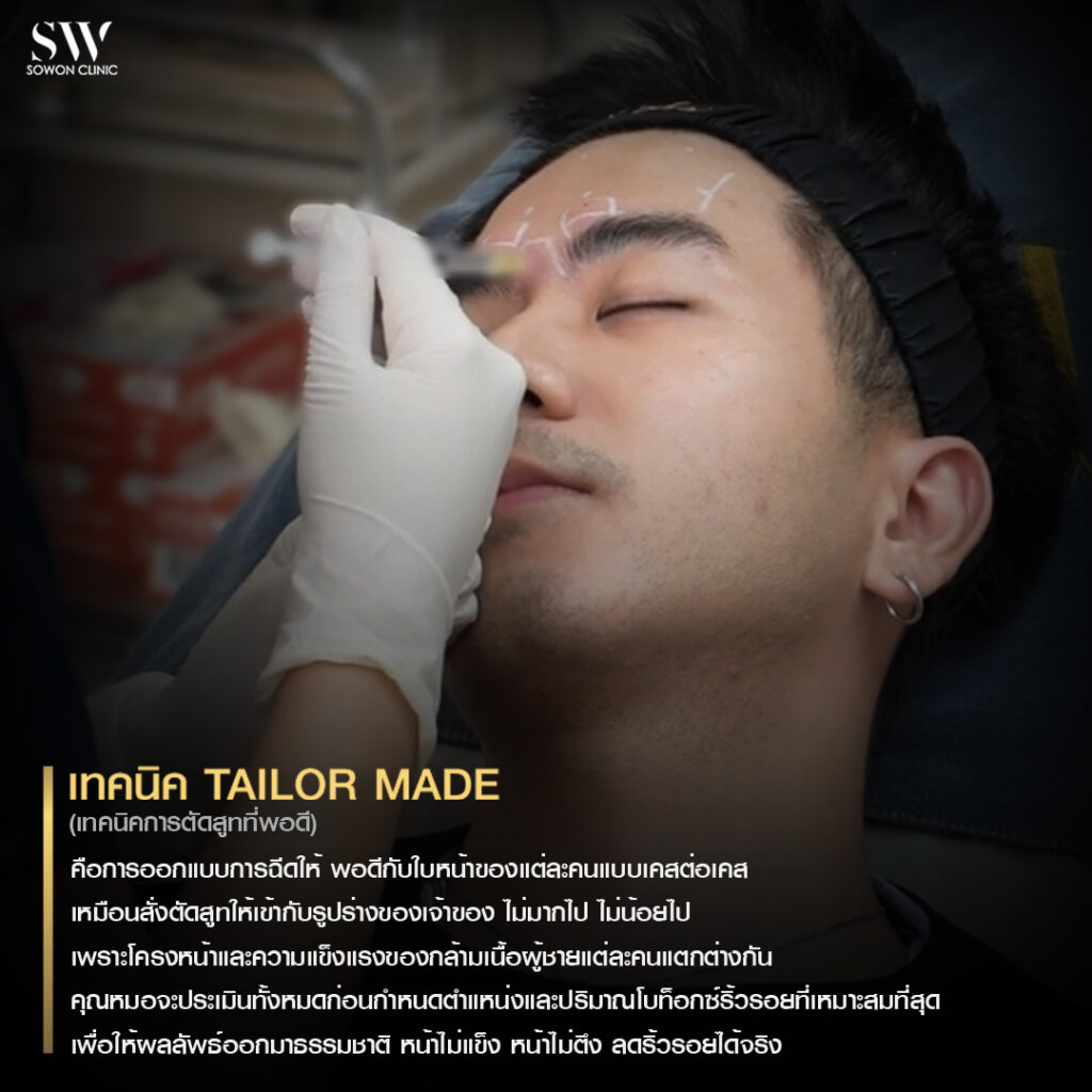 ริ้วรอย เทคนิค