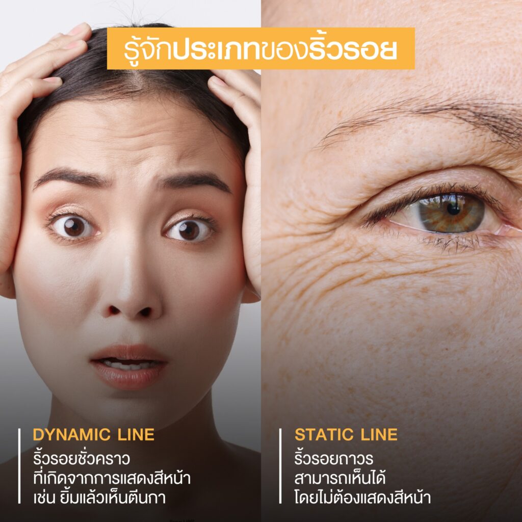 โบริ้วรอย ปัญหาริ้วรอย