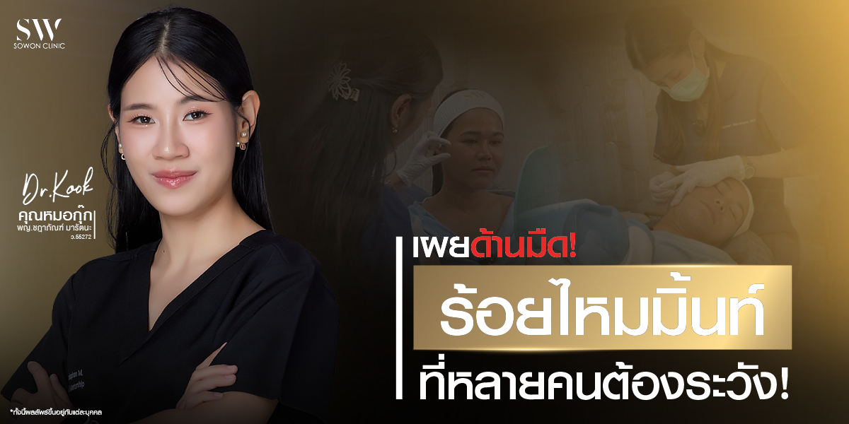 dangers-of-thread-lifting_skin-thread_knowledge dangers-of-thread-lifting_skin-thread_knowledge