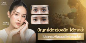 ปัญหาใต้ตาร่องลึก ใต้ตาคล้ำ ฟิลเลอร์ใต้ตาช่วยได้!