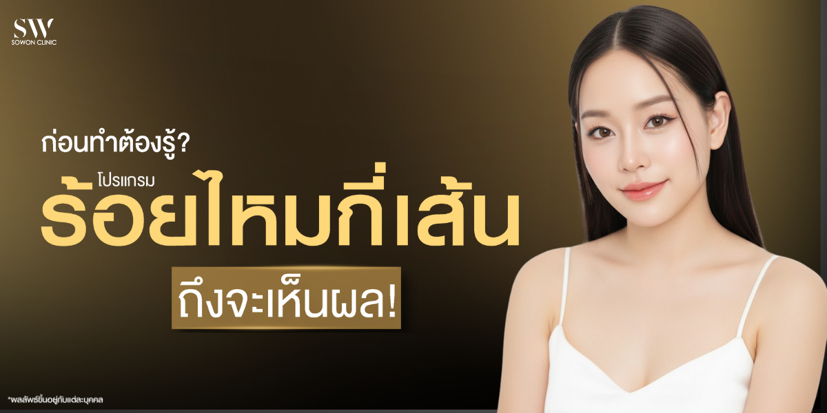 how-many-threads-for-thread-lift-skin-thread-knowledge