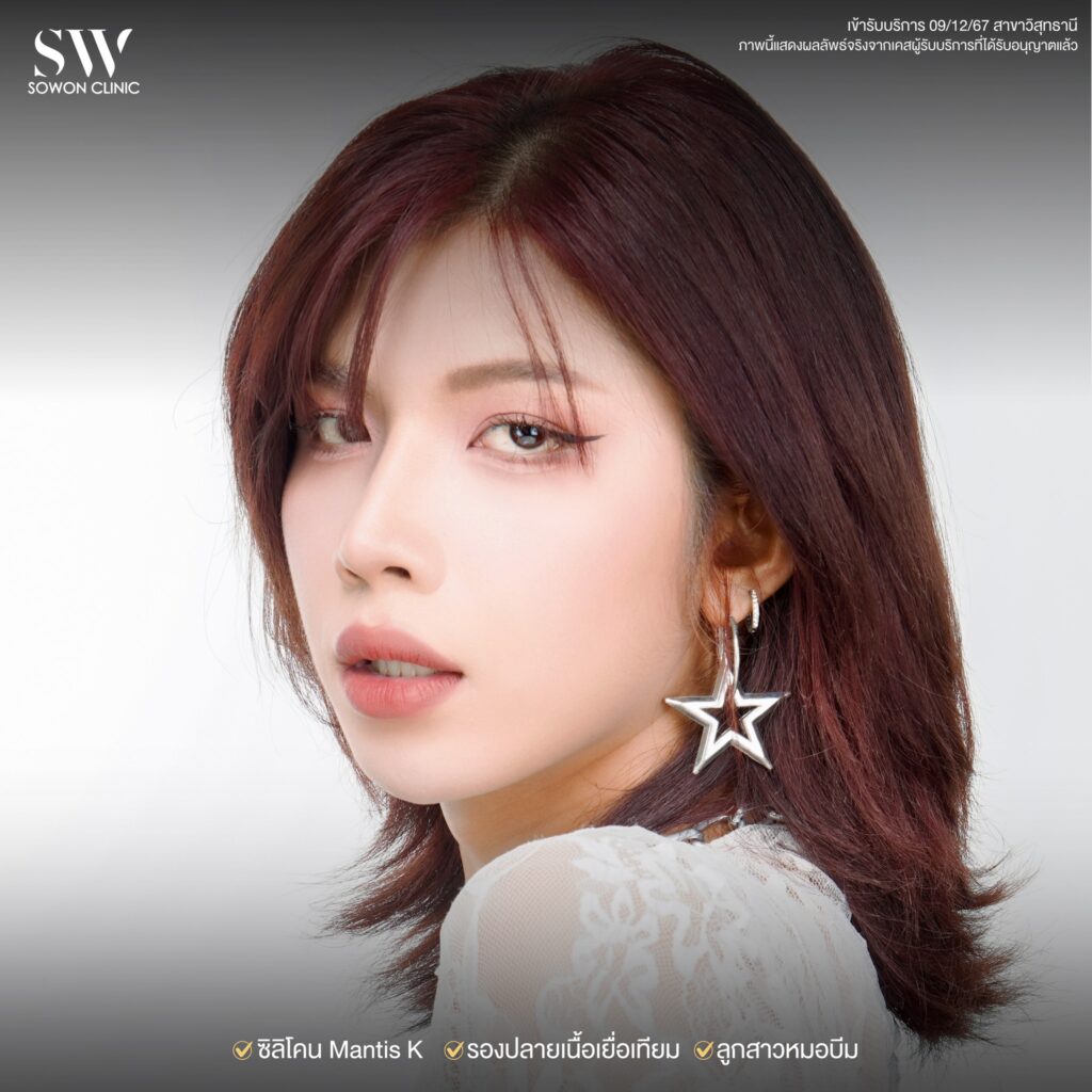 รีวิวเสริมจมูก รีวิว02