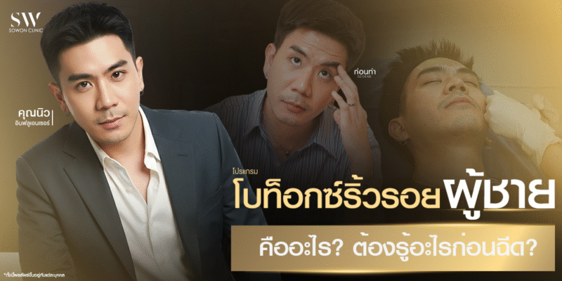 male-botox-wrinkle-guide_skin-botox-knowledge