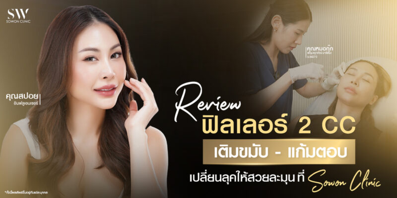 review-filler-2cc-case-zpoil-temple-cheek__skin-filler_review