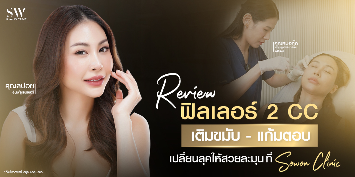 review-filler-2cc-case-zpoil-temple-cheek__skin-filler_review