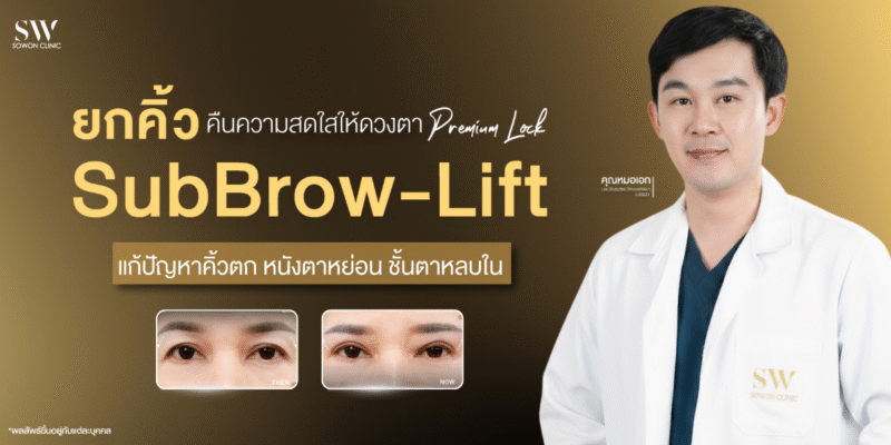 sub-brow-lift-fix-hooded-eyes-surgery-eye-knowledge