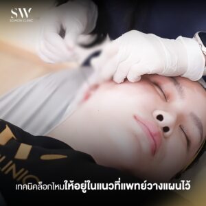 ยกกระชับ values02
