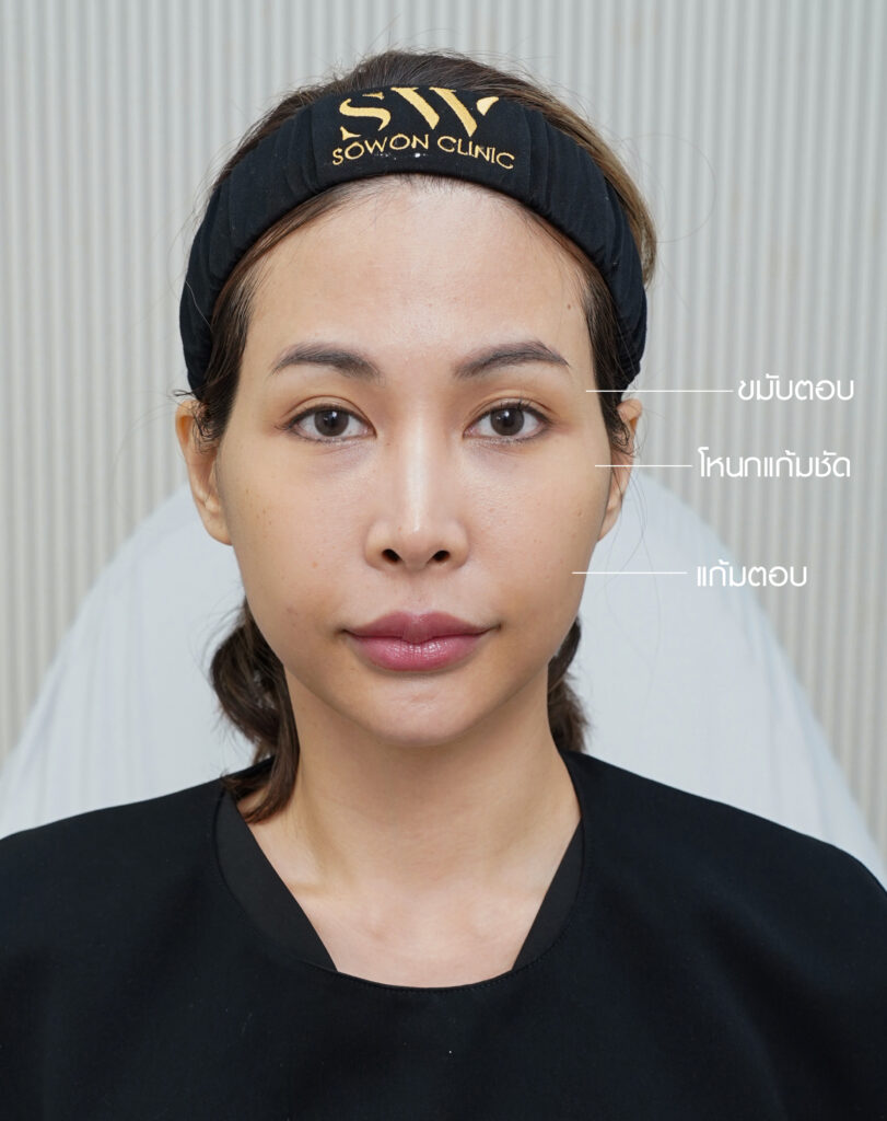 ปรับรูปหน้า ปัญหาหน้า