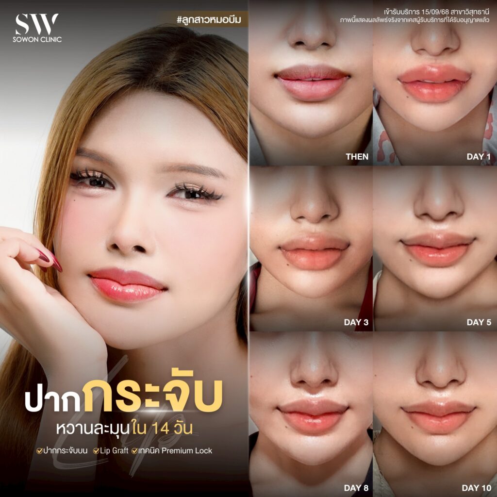 ปากกระจับหวานละมุน01