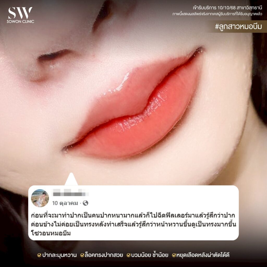 ปากกระจับหวานละมุน10