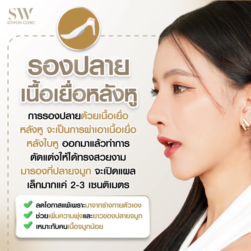 รีวิวเสริมจมูก 012