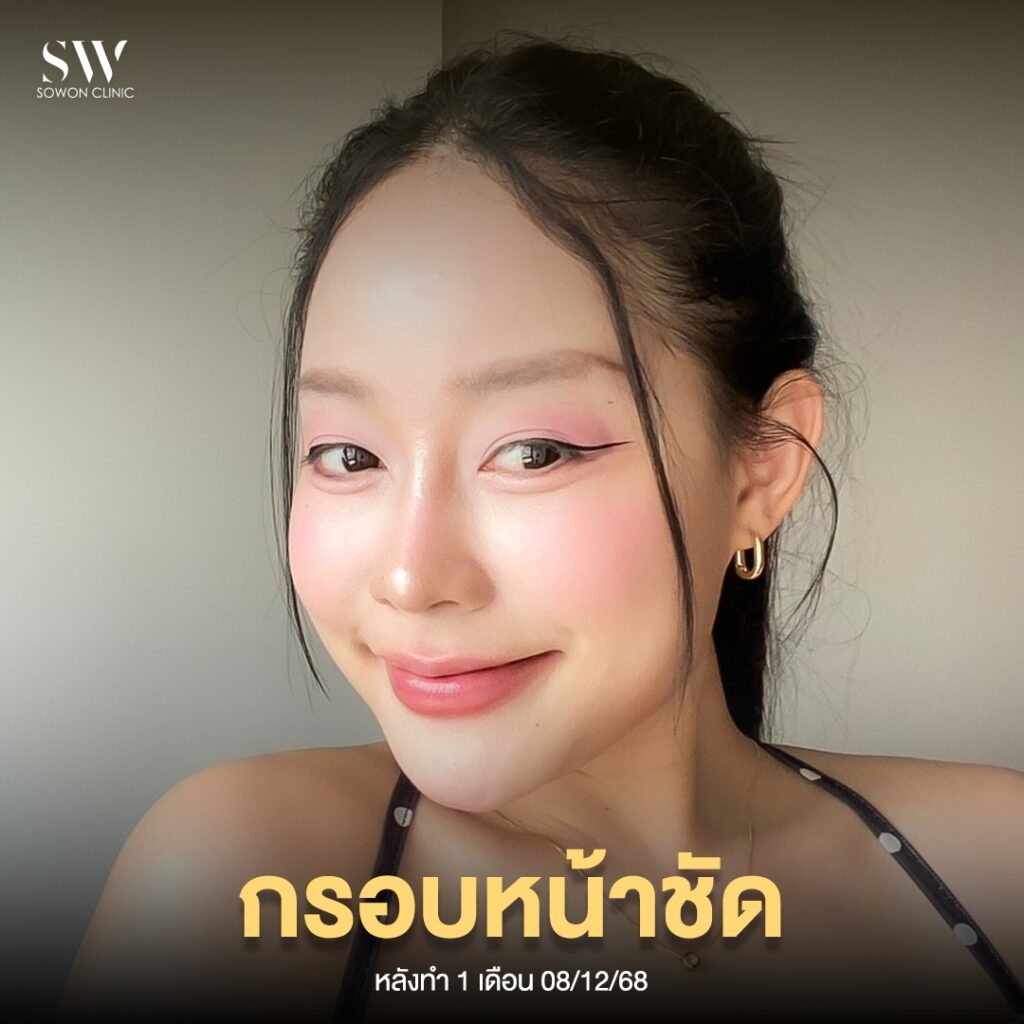 ร้อยไหม 002