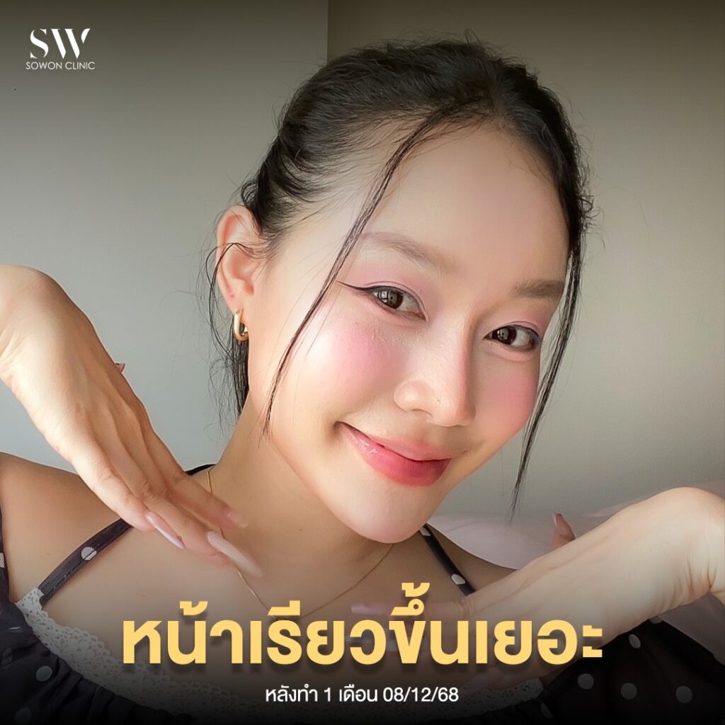 ร้อยไหม 003