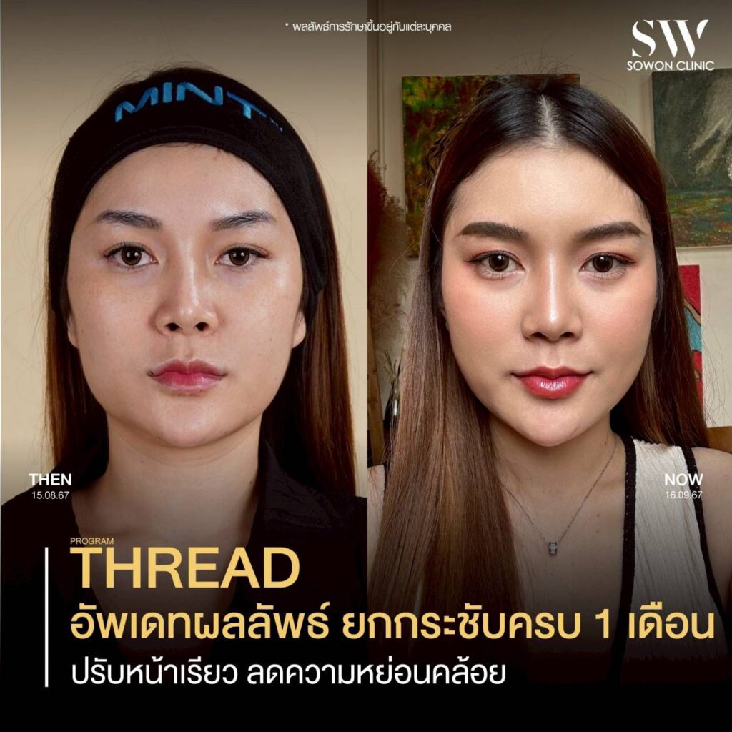 ร้อยไหม 006