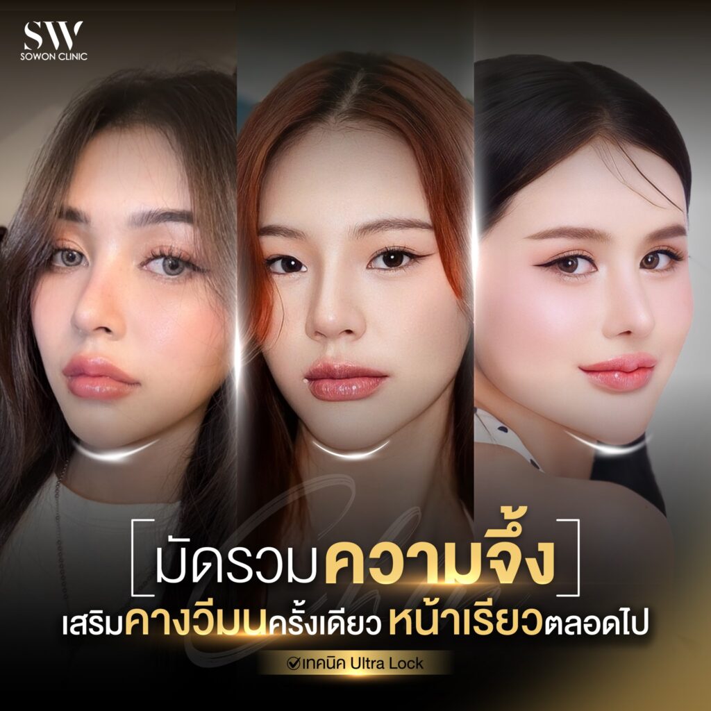 เสริมคาง009