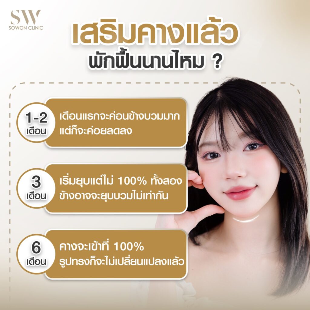 เสริมคาง012