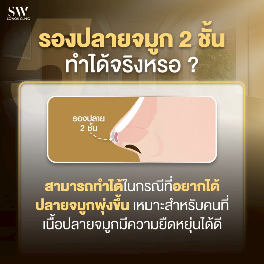 เสริมจมูกครั้งแรกต้องรู้อะไรบ้าง_รองปลายเทคนิค close05