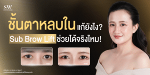 eyebrow-lift-hidden-eyelid-surgery-eye-knowledge