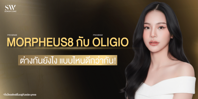 morpheus8-vs-oligio-which-is-better-skin-morpheus8-knowled